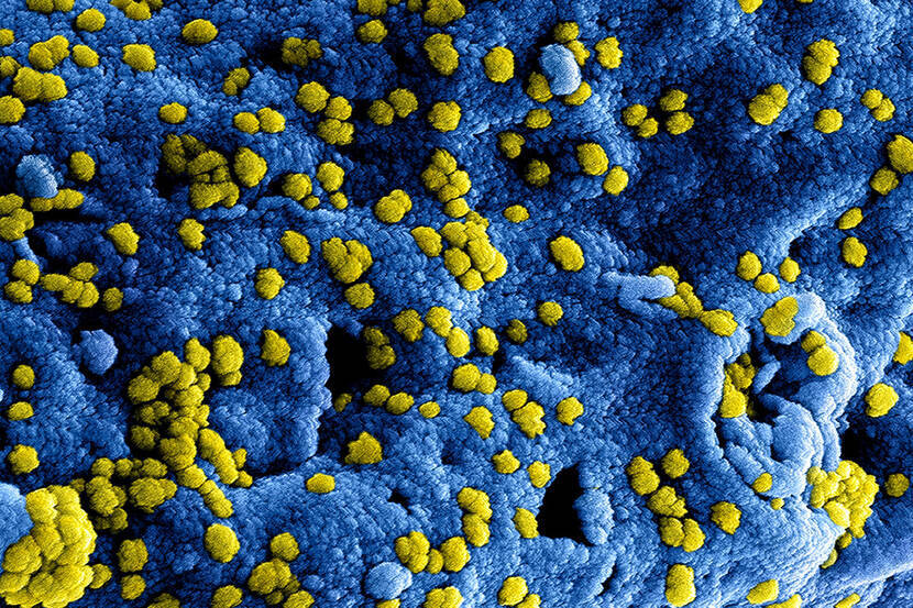 a6ae965c-coronavirus.jpg